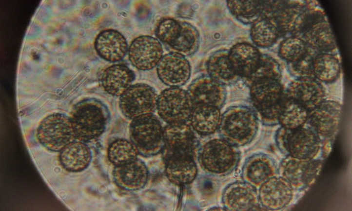 Ustilago maydis bajo un microscopio
