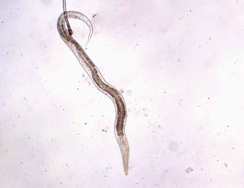 Una imagen horizontal de primer plano de un nematodo visto bajo un microscopio.