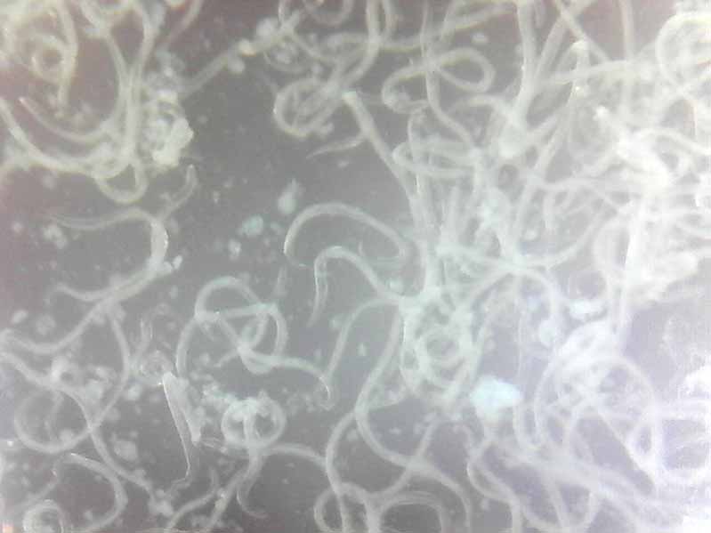 Vista microscópica de los nematodos Steinernema.