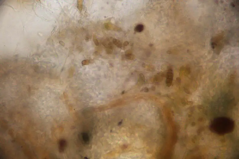 Una imagen horizontal de primer plano de las esporas del hongo Stemphylium visto bajo un microscopio.