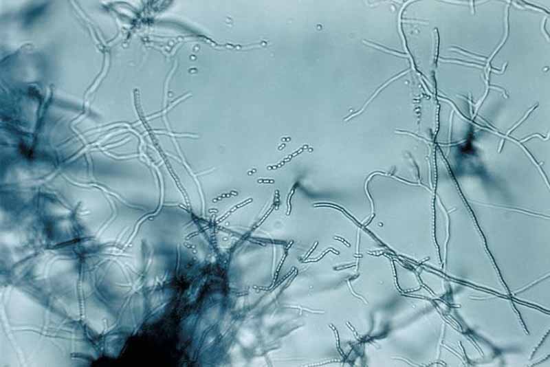 Una vista microscópica de la bacteria Streptomyces.